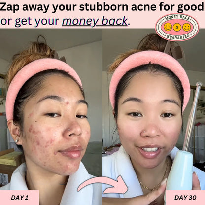 PrimaDerma™️ - High Frequency Derma Wand